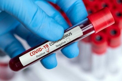 Coronavirus-Blood-Test-77-1598059400.jpg
